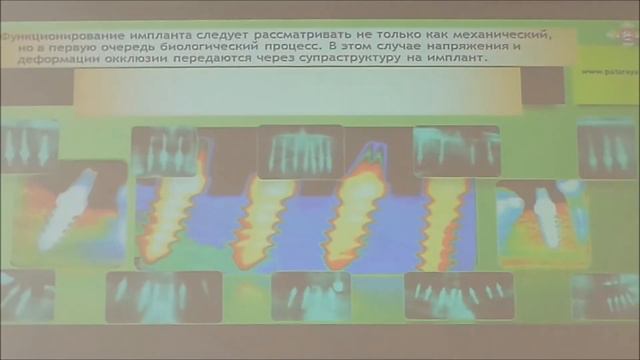 Georgi Pataraya фрагменты публичных выступлении о современной имплантации смотреть онлайн