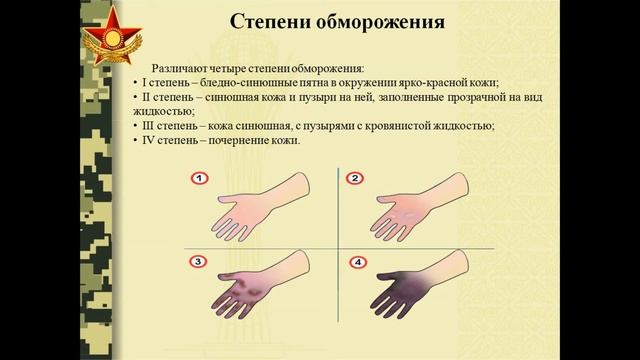 Видеоурок НВП смотреть онлайн