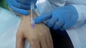 Биоревитализация рук