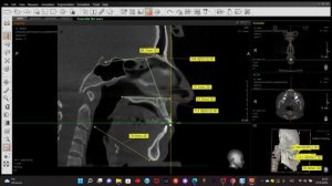 11. Как сделать реконструкцию ТРГ и ОПТГ из КТ