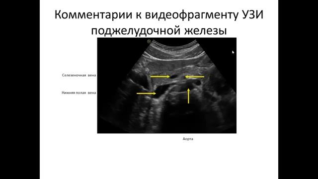 Ультразвуковая анатомия поджелудочной железы смотреть онлайн