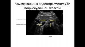 Ультразвуковая  анатомия поджелудочной железы
