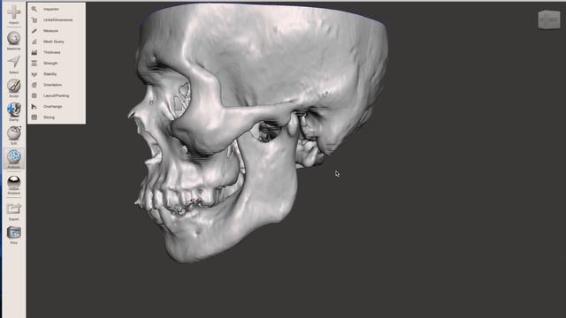How to convert DICOM file to 3D printable STL file смотреть онлайн
