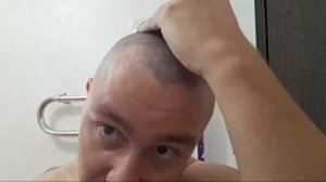 Псориаз. Очень сильное обострение!