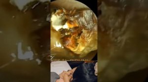 чистка ухо с помощью инструментов ] кошмар если честно