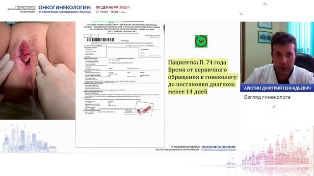 Взгляд гинеколога на хирургическое лечение впервые выявленных опухолей яичников. Арютин Д. Г. смотреть онлайн