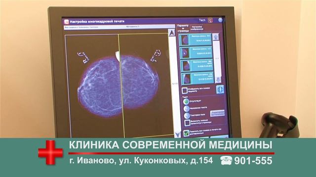 Клиника Современной Медицины- Маммография смотреть онлайн