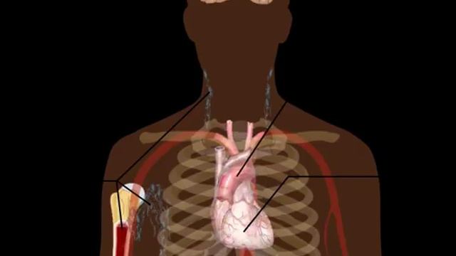 9 Often Overlooked Signs Your Body is FULL of Toxins Plus How to Naturally Detox смотреть онлайн