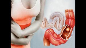 Старинное народное средство от запора