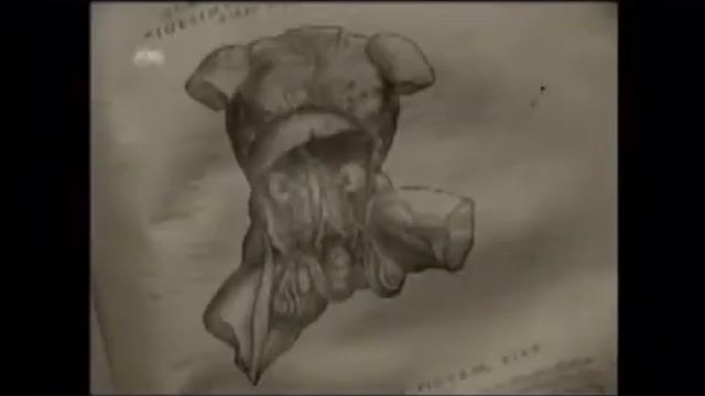 The history of surgery смотреть онлайн