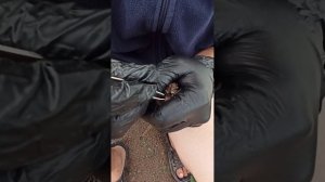 УДАЛЕНИЕ ЛИЧИНОК ОВОДА ИЗ ПТЕНЦА REMOVING GADDY LARVIES FROM BIRD