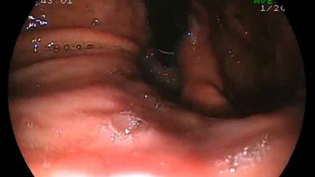 Comp 13.flv смотреть онлайн