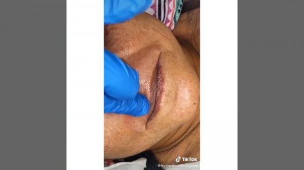 Most Extreme Beauty Treatments 2022 Best Smart and Helpful Beauty Hacks | Virtual Beauty