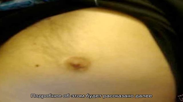 Волосы вокруг сосков у девушек, женщин, растут волосы вокруг ореолы: причины, почему растут и как . смотреть онлайн