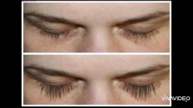 Касторовое Масло Творит Чудеса с Вами ! смотреть онлайн