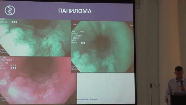 04 Ткаченко ОБ Эндоскопическая диагностика патологии Пищевода смотреть онлайн