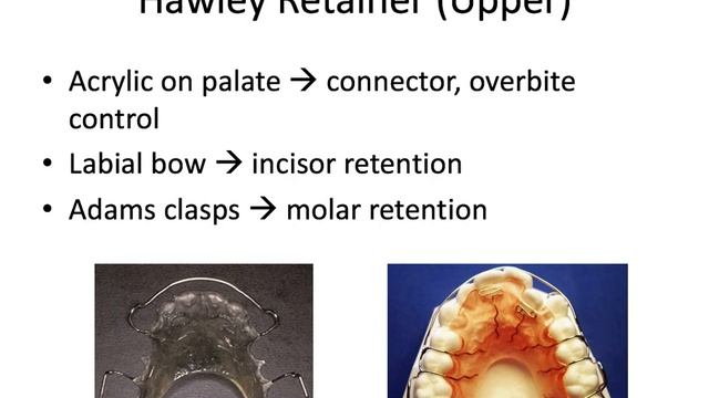 Orthodontics | Retention | INBDE, ADAT смотреть онлайн