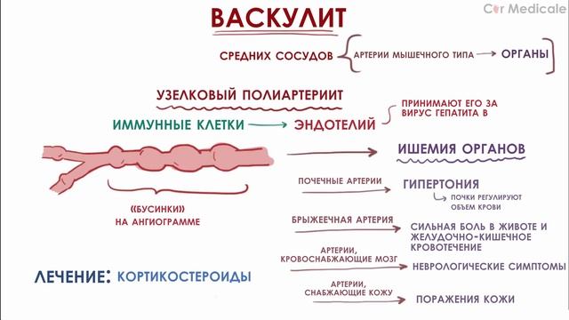 Васкулит смотреть онлайн