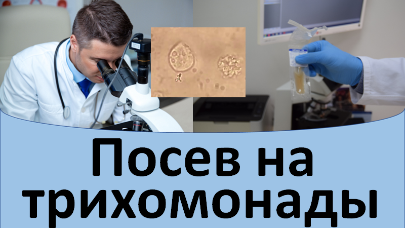 Посев на трихомонады смотреть онлайн