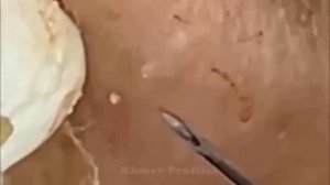 Enjoy Every Day With Loan Nguyen Spa Beauty New Video | 003