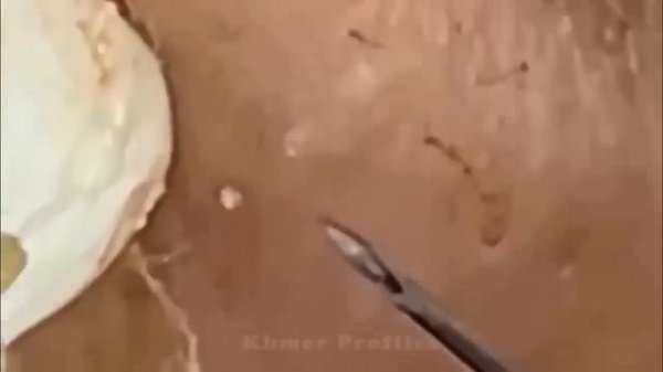 Enjoy Every Day With Loan Nguyen Spa Beauty New Video | 003