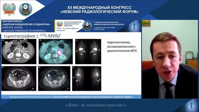 НАУЧНАЯ ШКОЛА «Ядерная кардиология в педиатрии» смотреть онлайн