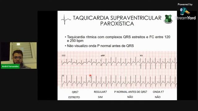 II MINI CURSO DE ECG - ARRITMIAS CARDÍACAS смотреть онлайн