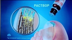 Реклама Микодерил #1