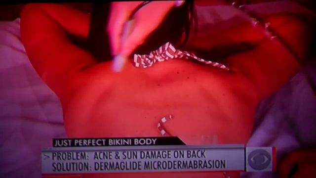Dermaglide all natural microdermabrasion system featured on CBS Early Show with Dr. Anthony Youn, M смотреть онлайн