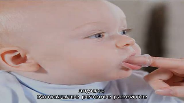 Что такое ринолалия и как лечить заболевание? смотреть онлайн
