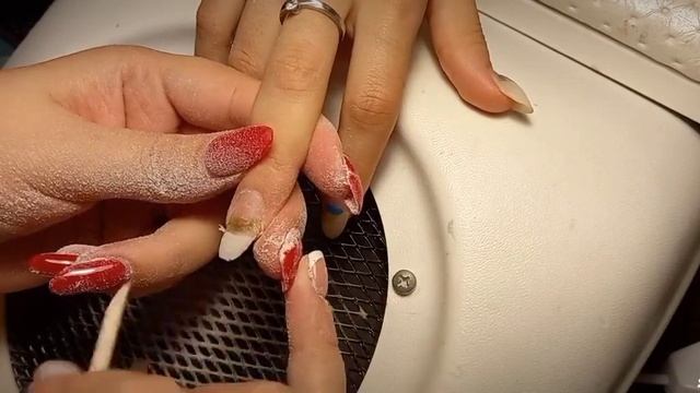 Отслойки. Ногтевая плесень . Ужааасс смотреть онлайн