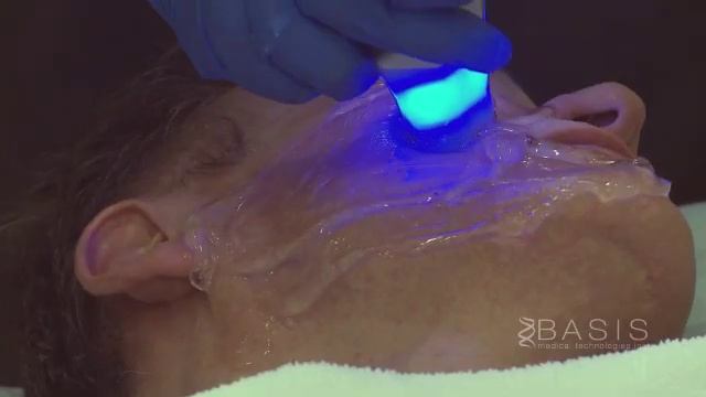 Exilis Elite смотреть онлайн
