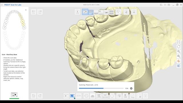 What's new in Medit Scan for Labs v1.3 смотреть онлайн