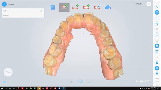 What Intra Oral Scanner Can Do For Your Practice - Introducing Aoralscan Intra-Oral Scanner смотреть онлайн