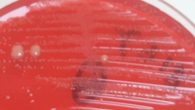 Enterococcus faecalis Colony Morphology on CLED Agar смотреть онлайн