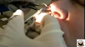 Уничтожение большой козявки