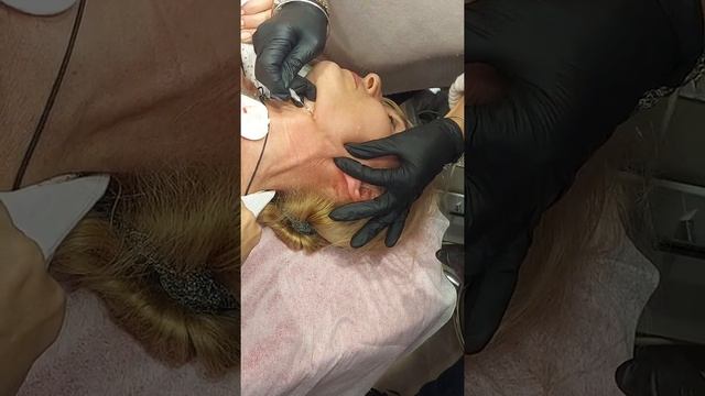 Нити COG 19g×100 .  Овал(фрагмент)