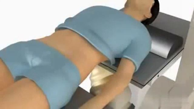 дистанционная литотрипсия