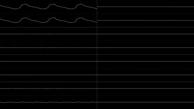 Torchkas - Groovy (Oscilloscope View) смотреть онлайн