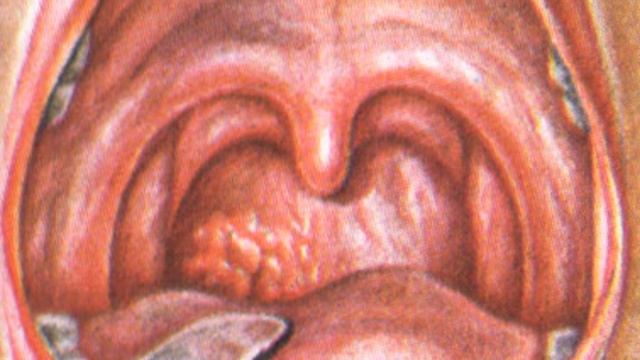 ❀≡Кўкйўтал касалиги❀≡Ko‘kyo‘tal kasaligi❀≡ смотреть онлайн