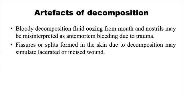 Post Mortem Artefacts |  Postmortem Artifacts | Forensic Science | Dr Krup Vasavda