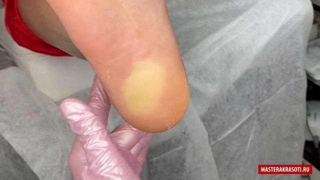 КОМБИНИРОВАННЫЙ ПЕДИКЮР: ремонт, дизайн ногтей смотреть онлайн