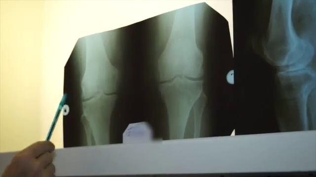 Медгард 2016-04-06 Воробьев смотреть онлайн