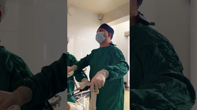 Navbatdagi oshqozon kichraytirish operatsiyasi. Bemorimizda semizlik 3-daraja vaznlari esa 115 kg. смотреть онлайн
