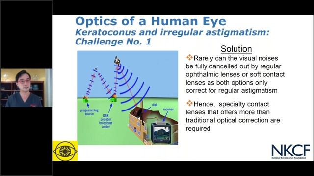 Chang Reaction Episode 1: What is Keratoconus? смотреть онлайн