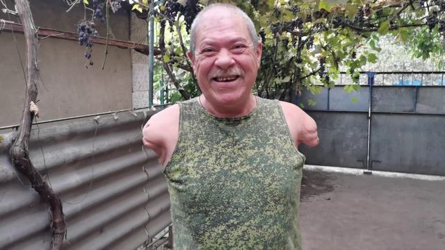 Я ДОЖДАЛСЯ ИЗГОТОВЛЕНИЯ ПРОТЕЗОВ?