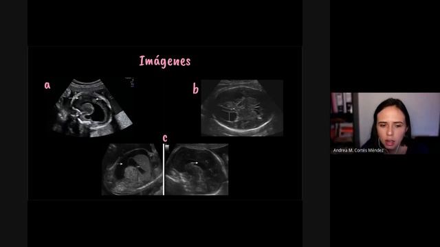 Toxoplasmosis en el embarazo смотреть онлайн