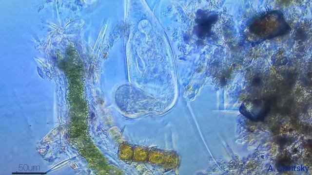 Инфузория туфелька под микроскопом \\ Paramecium caudatum under the microscope смотреть онлайн
