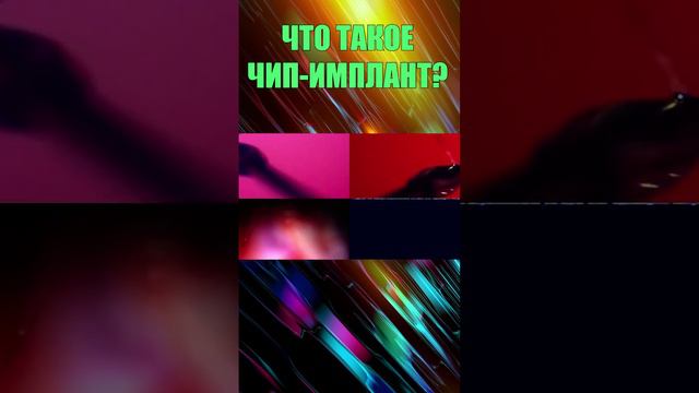 ИМПЛАНТ ЭТО