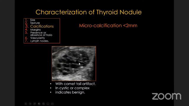 SONOGRAPHIC CHARACTERIZATION OF THYROID NODULES-INTERNATIONAL WEBINAR смотреть онлайн